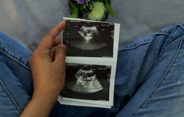 香港正规胎儿鉴定化验所报告出具快的有哪些.png 香港正规胎儿鉴定化验所报告出具快的有哪些.png